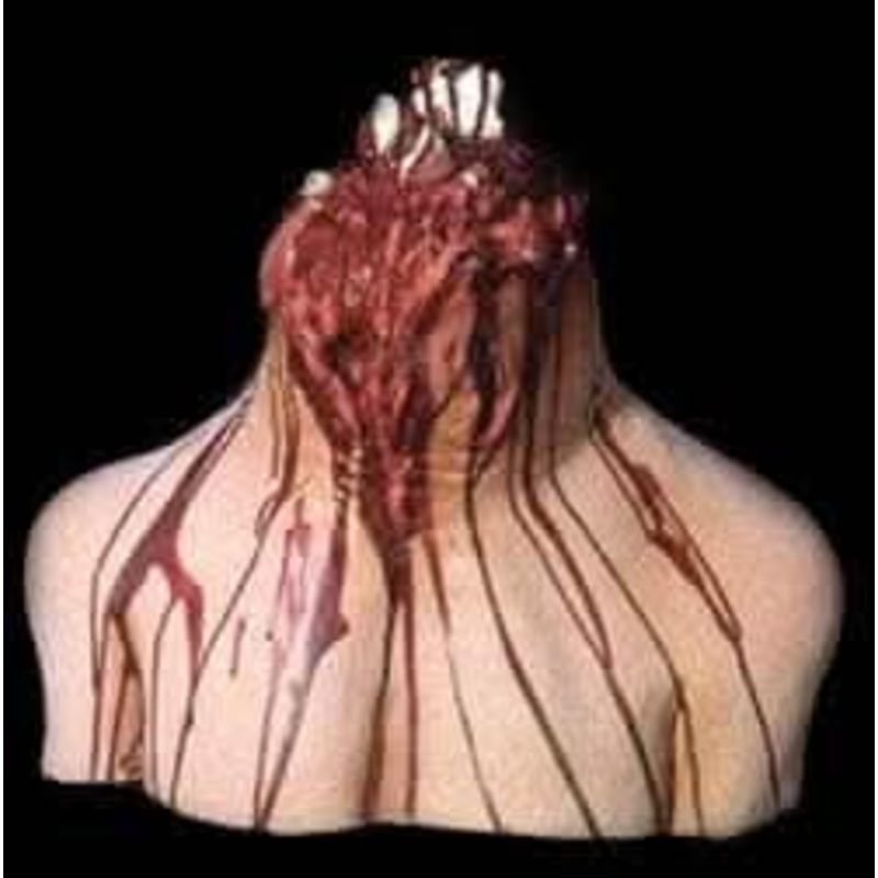 “Neck Stump” Mask